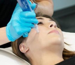 Behandling med SkinPen microneedling